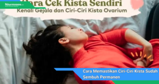 Cara Memastikan Ciri Ciri Kista Sudah Sembuh Permanen