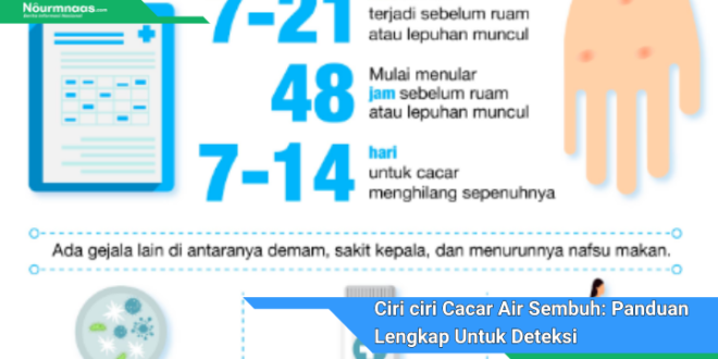 Ciri ciri Cacar Air Sembuh Panduan Lengkap Untuk Deteksi Dan Pencegahan